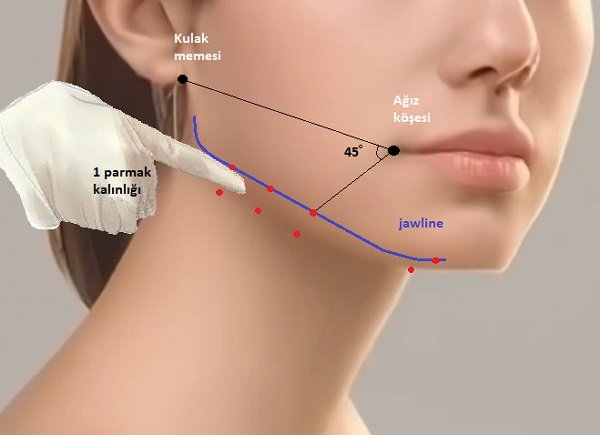 Platysma Botox Fiyatı Platysma Botox Fiyatı